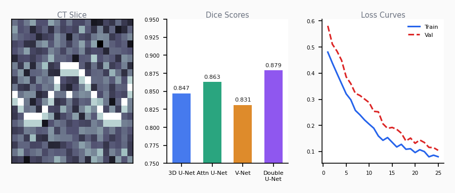 Vesuvius Challenge 3D segmentation